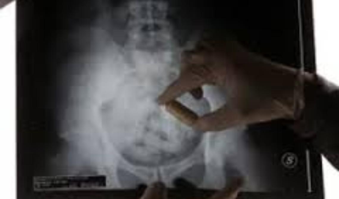 radiografia ovuli nell'addome