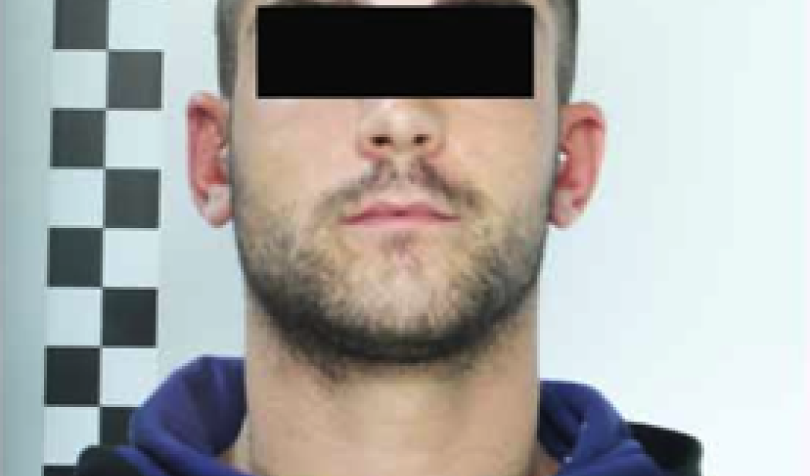 Tentano furto da "Vision Tecnica": arrestata la banda della "spaccata"