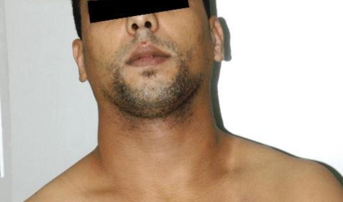 Cerignola, lotta al crimine: tre arresti per droga e rissa
