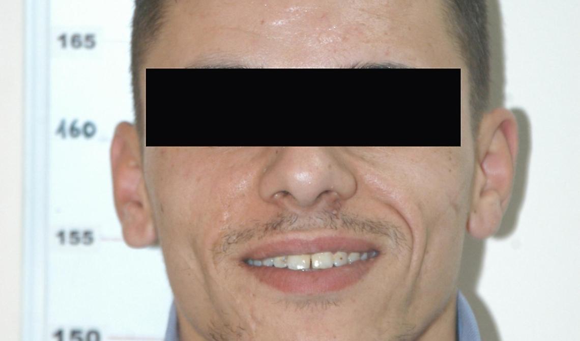 Tentò di estoricere denaro ad un assicuratore: torna in carcere Ivan Narciso