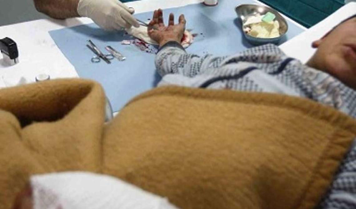 Botti di fine anno, si aggrava il numero dei feriti: 21enne perde la mano destra