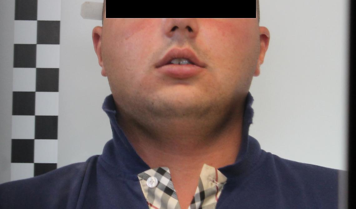 Tenta di uccidere il proprio meccanico: arrestato noto pregiudicato foggiano 