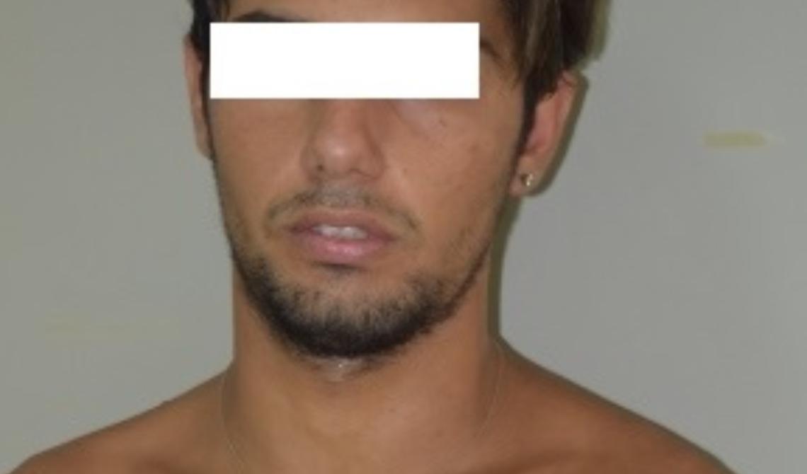 Quartiere San Samuele, escono di casa con mazze e grosso cacciavite  e se le danno di santa ragione: tre arresti 