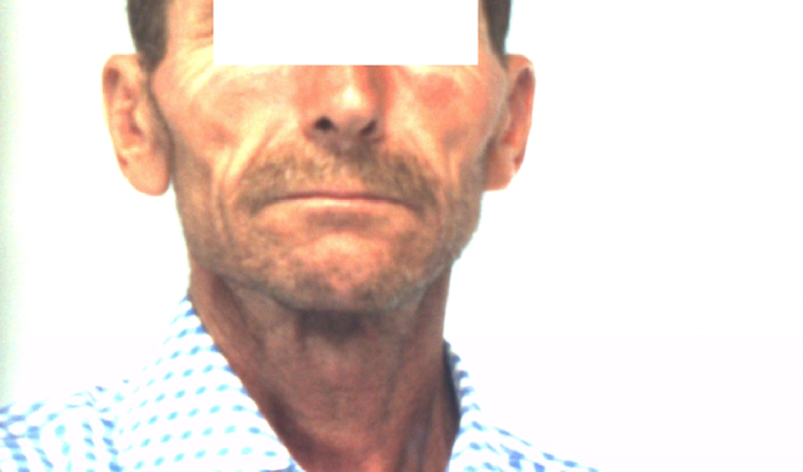 Ischitella, accoltella un connazionale per questioni di vicinato: arrestato rumeno