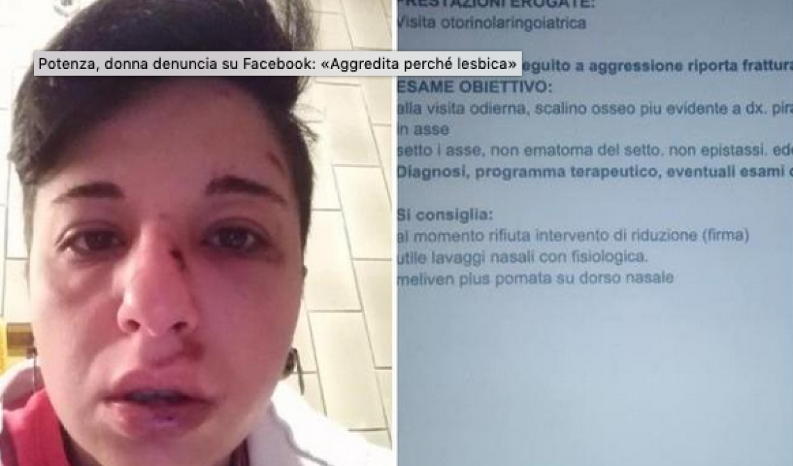 Potenza, donna denuncia: «Aggredita da due fascistelli perché lesbica»