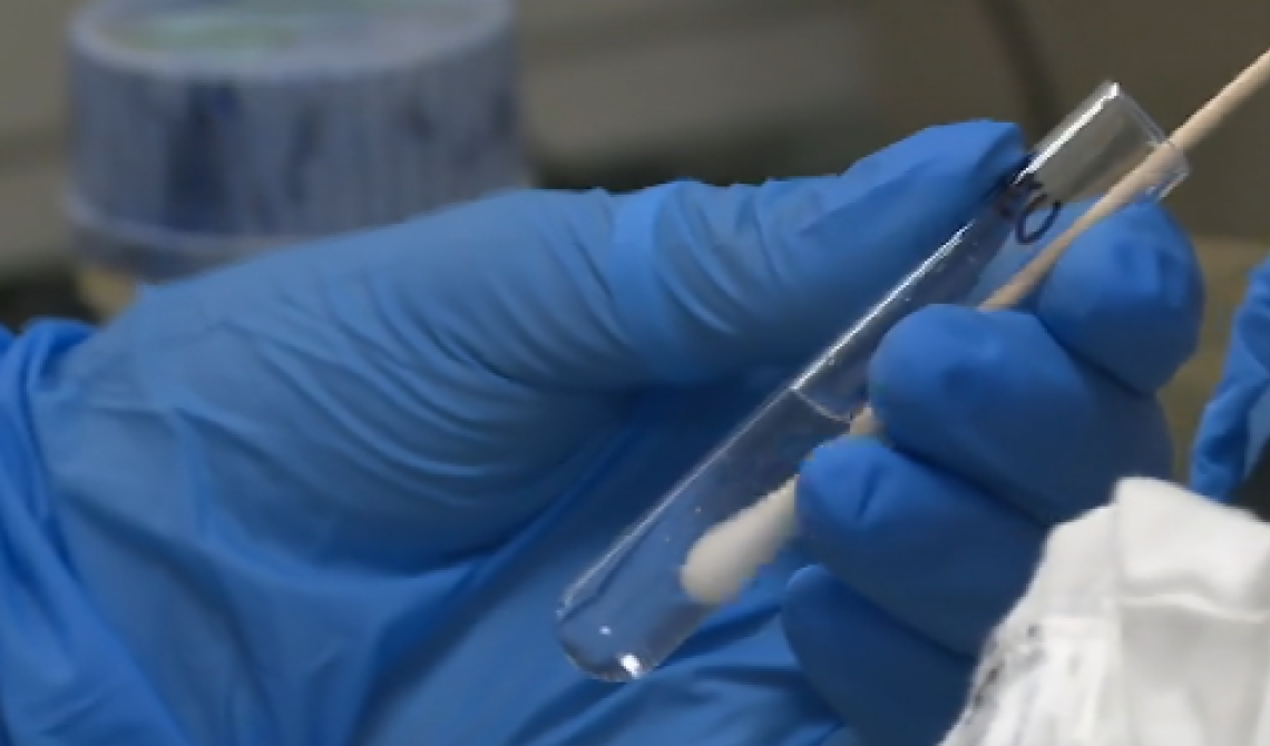 Coronavirus, Nnegativi gli ultimi cinque tamponi processati al San Carlo