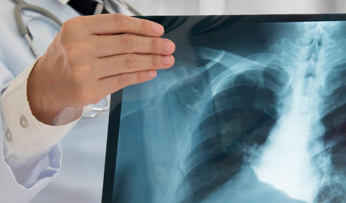 Coviello (Lega): «In occasione della Giornata Internazionale della radiologia, voglio ringraziare tutti i professionisti che hanno fornito un contributo indispensabile alla diagnosi e al trattamento d