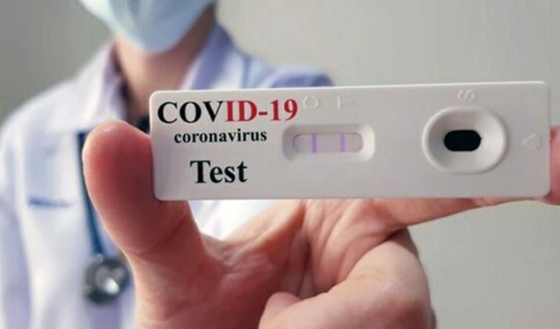 Coronavirus, test rapidi negli studi dei medici di base e dei pediatri dall'11 gennaio