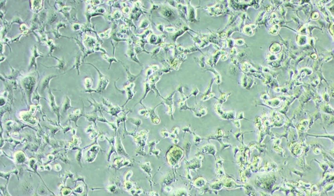 Isolata in Puglia la variante Omicron. Emiliano: "Ora avremo informazioni fondamentali per combattere il Covid"
