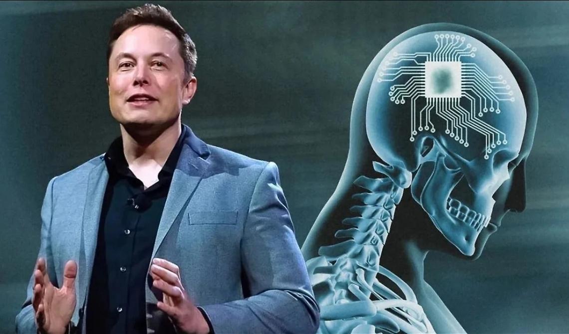 Neuralink: La Fantascienza Diventa Realtà e Rivoluziona l'Interazione Uomo-Macchina