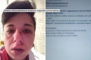 Potenza, donna denuncia: «Aggredita da due fascistelli perché lesbica»