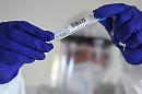 Coronavirus, calano i pazienti in terapia intensiva, ma ci sono 16 morti